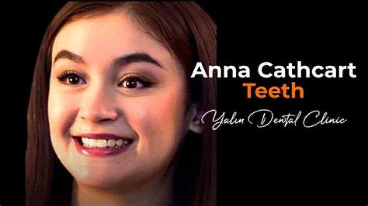 Anna Cathcart’s Teeth: What About The Gaps Between Them?