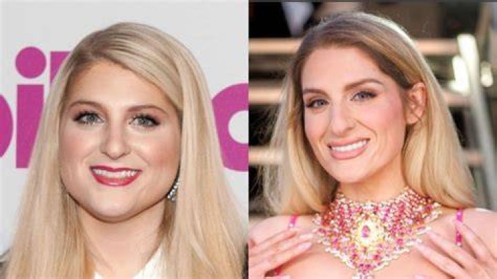 Meghan Trainor Teeth Before And After Veneers